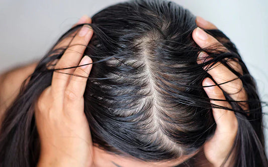 8 Common Causes of Greasy Roots and How to Fix Them