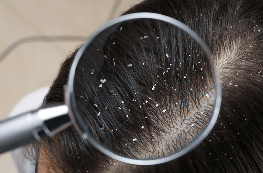 What's Behind An Unhealthy Scalp?