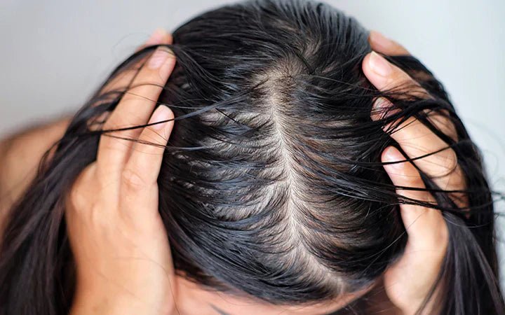 8 Common Causes of Greasy Roots and How to Fix Them – AneoSolution
