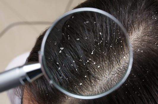 What's Behind An Unhealthy Scalp?