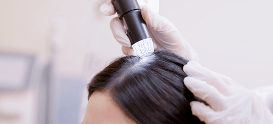 Best Scalp Analysis In Richmond Hill | Personalized Scalp Consultation At AneoSolution