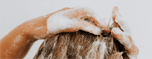 Can pH Balanced Shampoo Help Dandruff and Itchy Scalp? | Scalp Care in Toronto