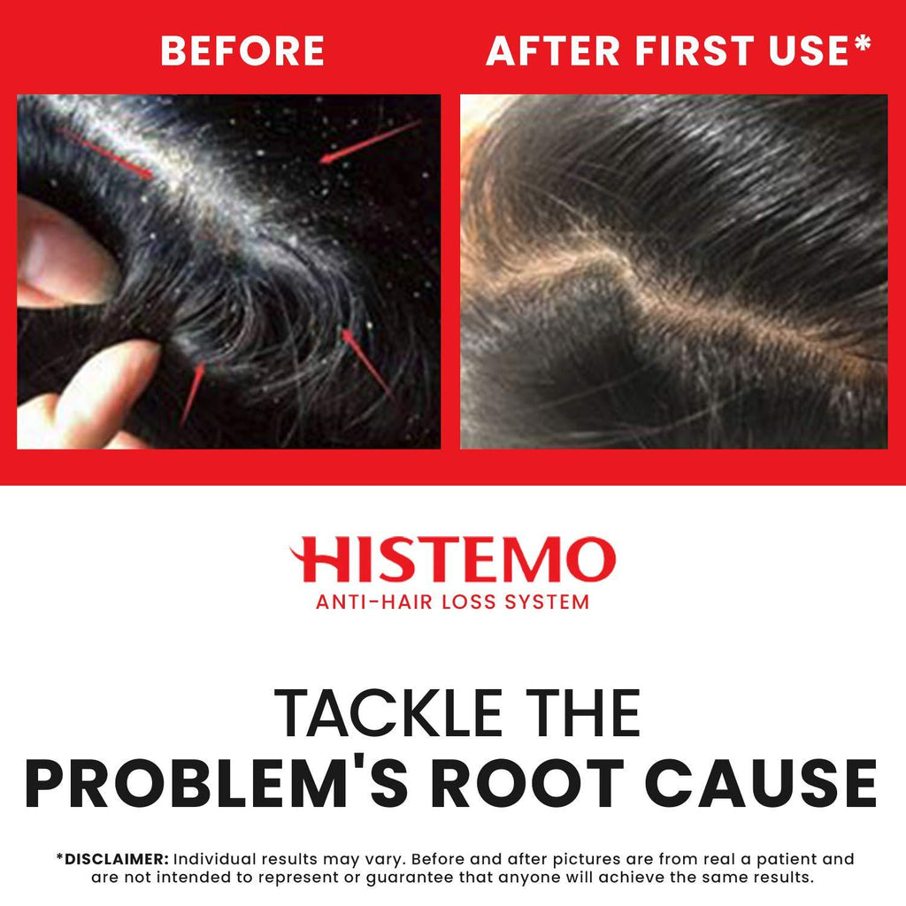 Histemo ION-TO S Scalp Cleanser Before and After