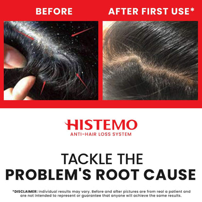 Histemo ION-TO S Scalp Cleanser Before and After